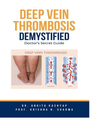 cover image of Deep Vein Thrombosis Demystified